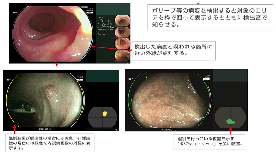 【画像】人工知能（AI）の診断支援